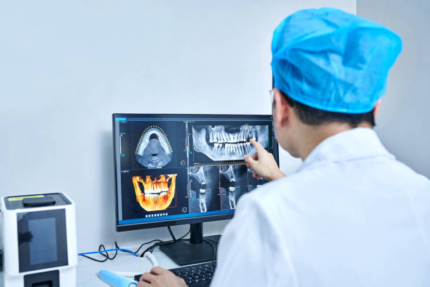 Best Emergency Dental Extractions in Shell Ridge, CA