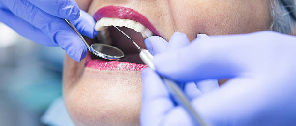 Best Pediatric Emergency Dentist in Shell Ridge, CA